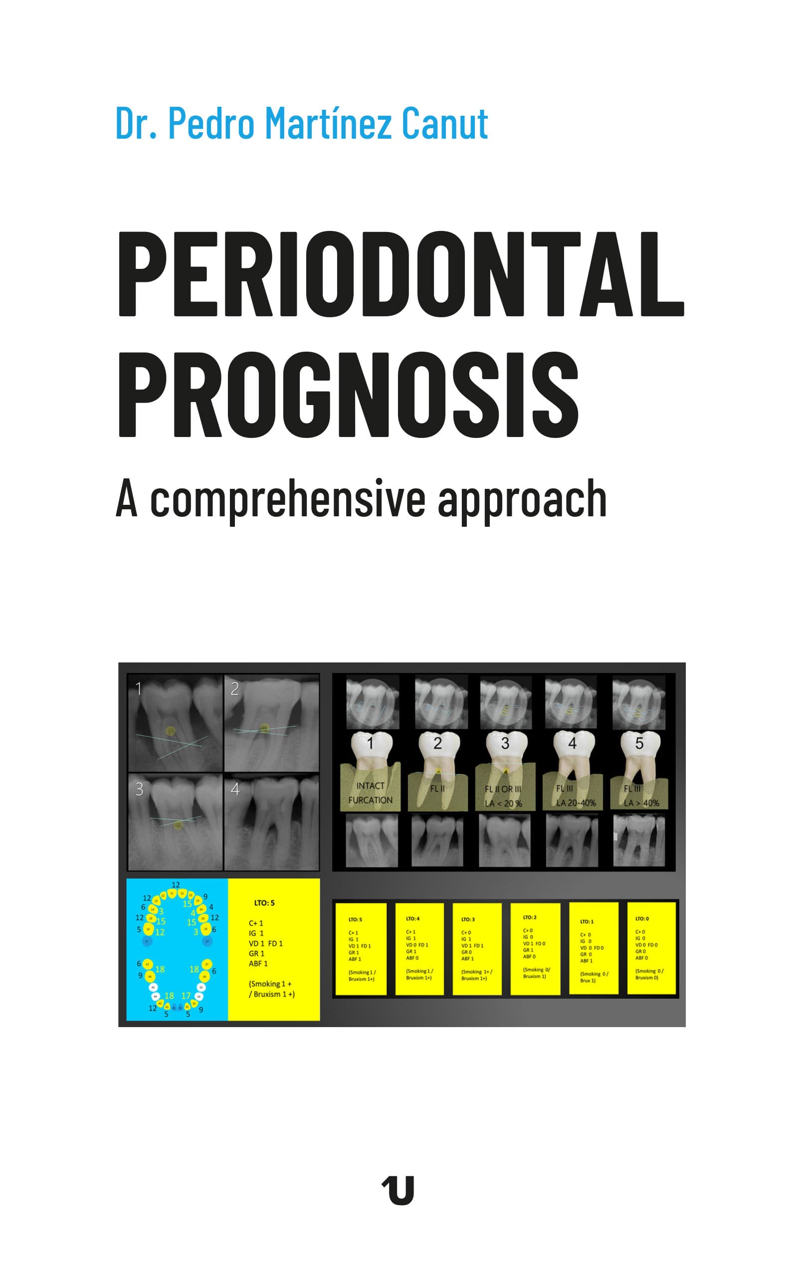 Periodontal prognosis. A comprehensive approach (Ed. UNO)