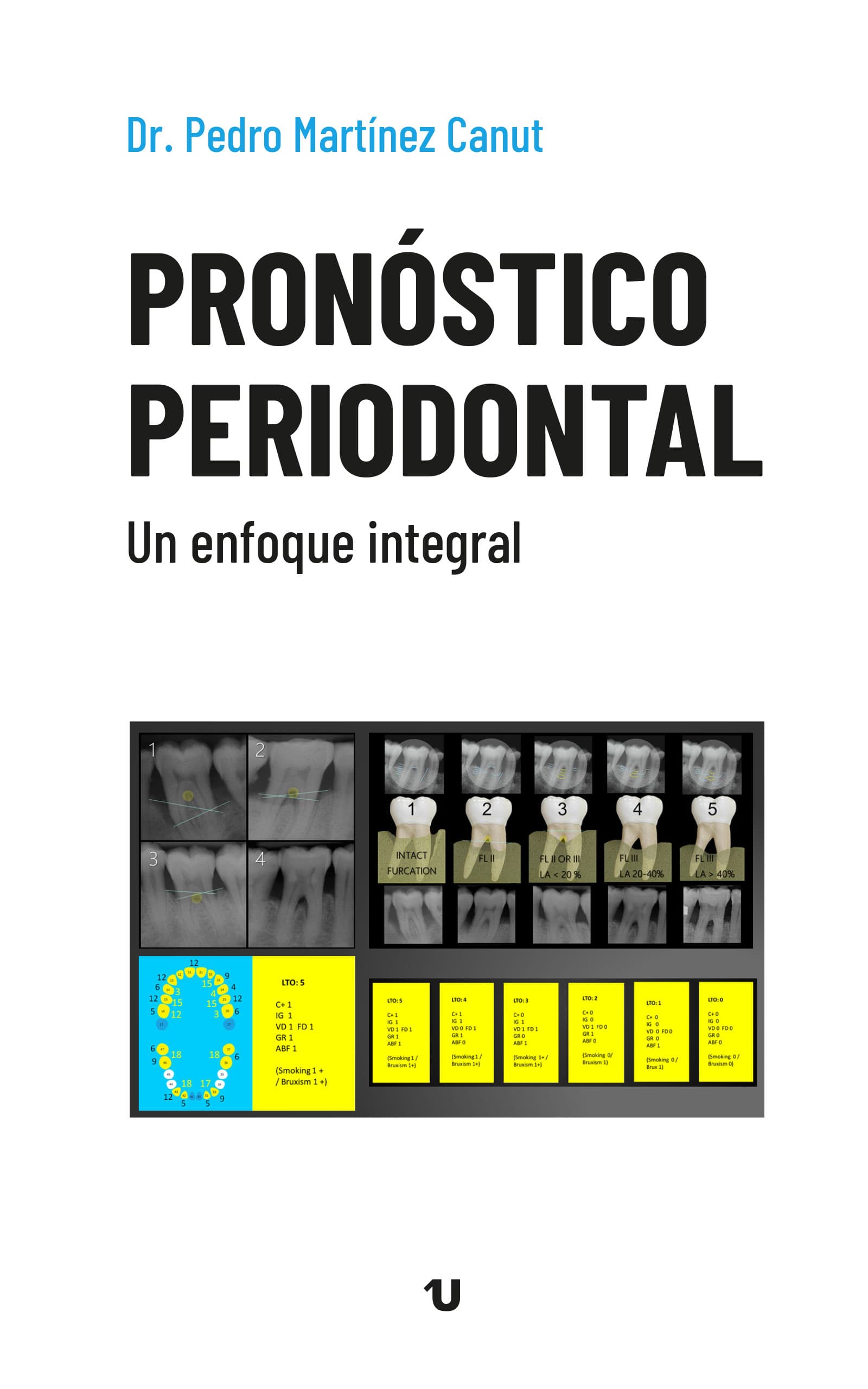Periodontal prognosis. A comprehensive approach (Ed. UNO)