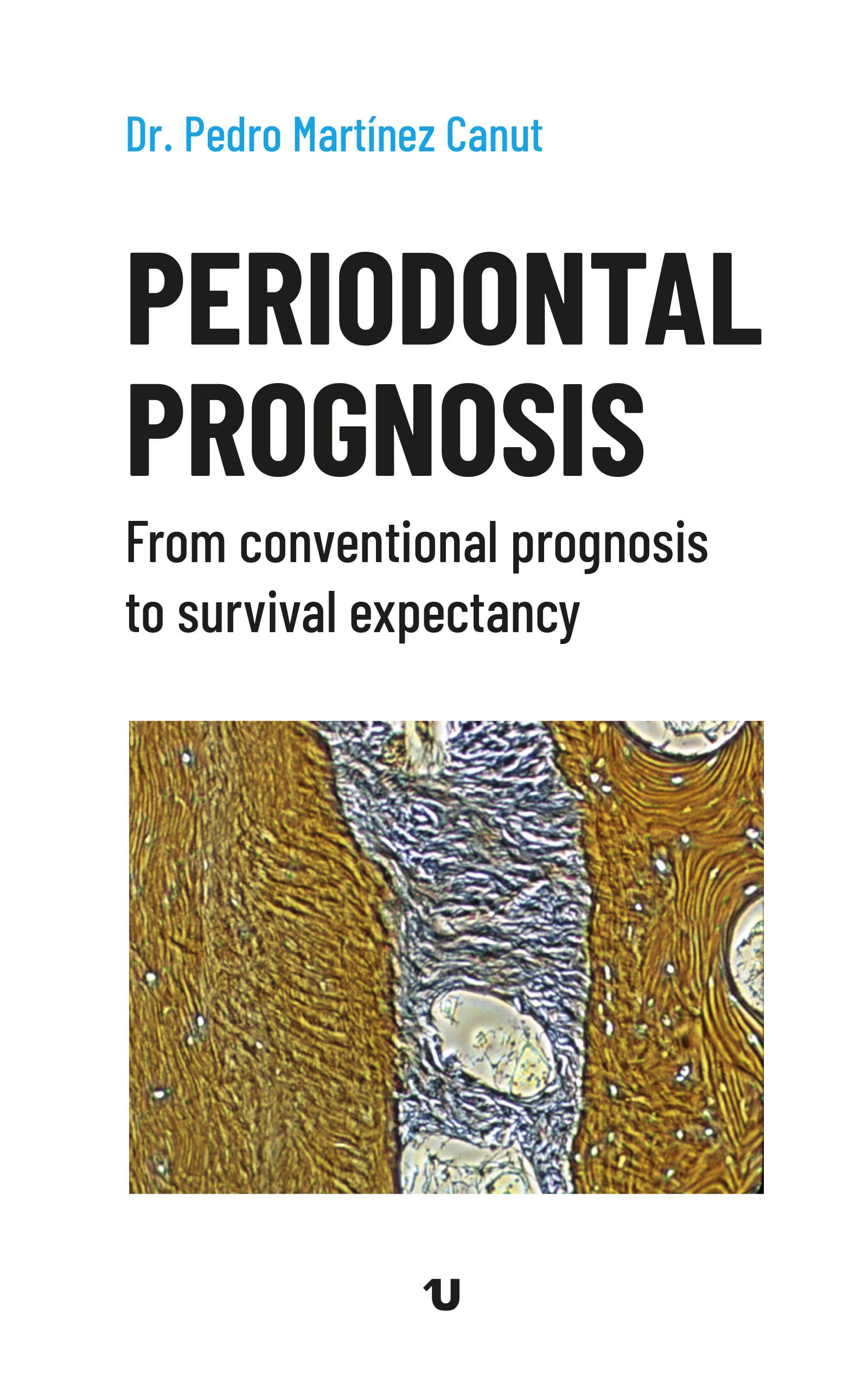Periodontal Prognosis (ED. UNO)